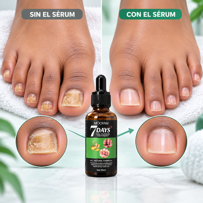 7 DAYS · Sérum reparador para uñas dañadas y amarillentas